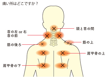 三鷹台鍼灸医院 痛い所はどこですか？